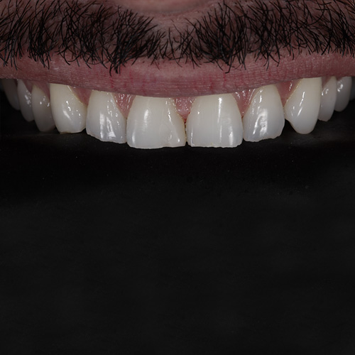 3 (1)